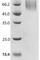 Human MHC Class I chain-related protein (MICA), partial Recombinant Protein, C-10His, aa 24–309, UniProt J9TPG6 - BioCrest Sci
