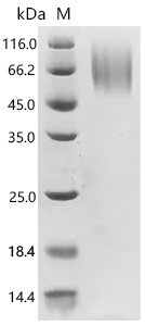 Human MHC Class I chain-related protein (MICA), partial Recombinant Protein, C-10His, aa 24–309, UniProt J9TPG6, Homo sapiens (Human), Yeast, C-terminal 10xHis-tagged, 34.8 kDa, purity >≥ 95% as determined by SDS-PAGE.