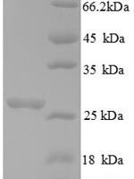 Saccharomyces cerevisiae Chitin synthase 1 (CHS1), partial Recombinant Protein - BioCrest Sci