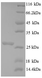 Saccharomyces cerevisiae Chitin synthase 1 (CHS1), partial Recombinant Protein, Saccharomyces cerevisiae (strain ATCC 204508 / S288c) (Baker\'s yeast), E.coli, N-terminal 6xHis-tagged, 26.6 kDa, purity >≥ 90% as determined by SDS-PAGE.