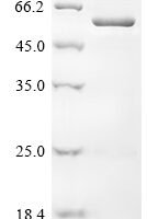 Newcastle disease virus Nucleoprotein (N) Recombinant Protein - BioCrest Sci