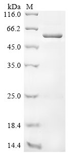 Newcastle disease virus Nucleoprotein (N) Recombinant Protein, Newcastle disease virus (strain Beaudette C/45) (NDV), E.coli, N-terminal 10xHis-tagged and C-terminal Myc-tagged, 58.1 kDa, purity >≥ 85% as determined by SDS-PAGE.
