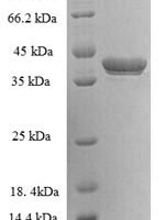 Human G antigen 5 (GAGE5) Recombinant Protein - BioCrest Sci