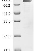 Escherichia coli Elongation factor G (fusA) Recombinant Protein - BioCrest Sci