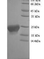 Human Putative inactive neutral ceramidase B (ASAH2B) Recombinant Protein, N-His, aa 1–165, Yeast - BioCrest Sci