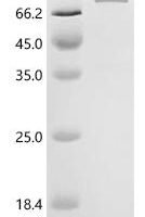 Human Eosinophil peroxidase (EPX) Recombinant Protein, C-His, aa 140–715, E.coli - BioCrest Sci