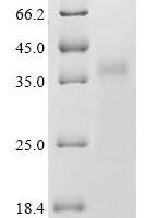 Candida albicans Hyphally-regulated protein (HYR1), partial Recombinant Protein, N-His-SUMOstar - BioCrest Sci