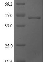 Baker's yeast Cystathionine gamma-lyase (CYS3), partial Recombinant Protein - BioCrest Sci