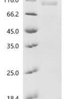 Human Polypyrimidine tract-binding protein 1 (PTBP1) Recombinant Protein, C-hFc1-Myc - BioCrest Sci