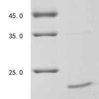 Hepatitis B virus genotype B/C subtype adw External core antigen (C), partial Recombinant Protein, Tag-Free - BioCrest Sci