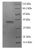 Human herpesvirus 1 Envelope glycoprotein G (gG US4 ) Recombinant Protein - BioCrest Sci