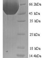 Rat Multiple inositol polyphosphate phosphatase 1 (Minpp1) Recombinant Protein, N-His, aa 31–481, Yeast - BioCrest Sci