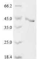 Rat Stanniocalcin-2 (Stc2) Recombinant Protein - BioCrest Sci