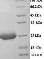 Mouse Complement C1q subcomponent subunit A (C1qa) Recombinant Protein - BioCrest Sci