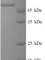 Human Dehydrogenase/reductase SDR family member 7 (DHRS7) Recombinant Protein - BioCrest Sci