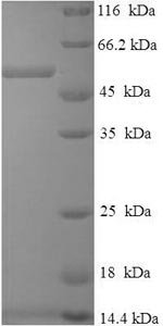 Human Dehydrogenase/reductase SDR family member 7 (DHRS7) Recombinant Protein, Homo sapiens (Human), E.coli, N-terminal 6xHis-SUMO-tagged, 50.9 kDa, purity >≥ 90% as determined by SDS-PAGE.
