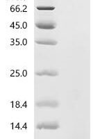 Human Coagulation factor IX (F9), partial Recombinant Protein, N-His - BioCrest Sci