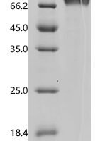 Human Interleukin-7 receptor subunit alpha (IL7R), partial Recombinant Protein, C-hFc1 - BioCrest Sci