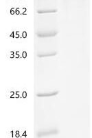 Human Protein mono-ADP-ribosyltransferase PARP14 (PARP14), partial Recombinant Protein, N-hFc - BioCrest Sci