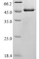 Avian infectious bronchitis virus Nucleoprotein (N) Recombinant Protein, C-His, aa 1–409, strain SAIB20, E.coli - BioCrest Sci