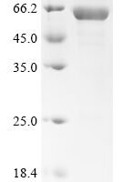 Mouse Homeobox protein Nkx-3.2 (Nkx3-2) Recombinant Protein, N-10His-SUMO, aa 1–333, Purity ≥85% - BioCrest Sci