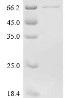 Mouse Matrix metalloproteinase-14 (Mmp14) Recombinant Protein - BioCrest Sci