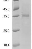Human Ly6/PLAUR domain-containing protein 1 (LYPD1) Recombinant Protein, N-His-SUMOstar - BioCrest Sci