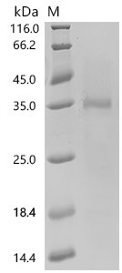 Human Ly6/PLAUR domain-containing protein 1 (LYPD1) Recombinant Protein, N-His-SUMOstar, Homo sapiens (Human), Yeast, N-terminal 6xHis-sumostar-tagged, 23.6 kDa, purity >≥ 85% as determined by SDS-PAGE.
