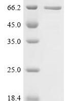 Human Phosphoprotein associated with glycosphingolipid-enriched microdomains 1(PAG1), partial Recombinant Protein - BioCrest Sci