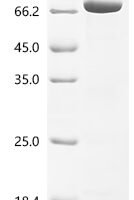 Corynephage beta Diphtheria toxin, partial Recombinant Protein - BioCrest Sci