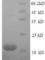 Mouse Major urinary protein 2 (Mup2) Recombinant Protein, N-His, aa 19–180, E.coli - BioCrest Sci