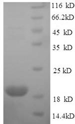 Mouse Major urinary protein 2 (Mup2) Recombinant Protein, N-His, aa 19–180, E.coli, Mus musculus (Mouse), E.coli, N-terminal 6xHis-tagged, 22.7 kDa, purity >≥ 90% as determined by SDS-PAGE.