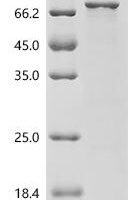 Human FRAS1-related extracellular matrix protein 1 (FREM1) Recombinant Protein - BioCrest Sci
