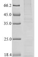 Human Interleukin-8 (CXCL8), partial Recombinant Protein, N-His, aa 23–99 - BioCrest Sci