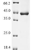 Human Bone marrow proteoglycan (PRG2), partial Recombinant Protein - BioCrest Sci