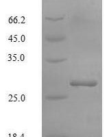 Human Potassium-transporting ATPase subunit beta (ATP4B), partial Recombinant Protein, N-GST - BioCrest Sci