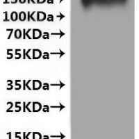 Human Interleukin-10 receptor subunit alpha (IL10RA) (3-6: PCLV→GCVL)-VLPs Recombinant Protein - BioCrest Sci