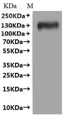 Human Interleukin-10 receptor subunit alpha (IL10RA) (3-6: PCLV→GCVL)-VLPs Recombinant Protein, Homo sapiens (Human), Mammalian cell, C-terminal 10xHis-tagged, 62.2 kDa, purity >VLPs