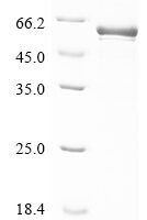 Mouse Cytochrome P450 3A16 (Cyp3a16) Recombinant Protein - BioCrest Sci
