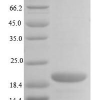 Human E3 ubiquitin-protein ligase TRIP12 (TRIP12), partial Recombinant Protein, N-10His/C-Myc, aa 1881–1992, E.coli - BioCrest Sci