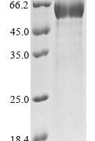 Mouse Sclerostin (Sost) Recombinant Protein - BioCrest Sci