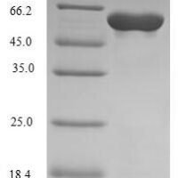 Human DNA-directed DNA/RNA polymerase mu (POLM) Recombinant Protein, N-10His - BioCrest Sci