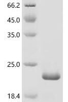 Human papillomavirus type 34 Protein E7 (E7) Recombinant Protein - BioCrest Sci
