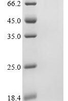 Mouse Alanine--tRNA ligase, cytoplasmic (Aars1) Recombinant Protein, C-10His - BioCrest Sci