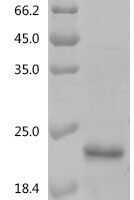 Mouse Transforming growth factor beta-3 proprotein (Tgfb3), partial Recombinant Protein, C-His - BioCrest Sci