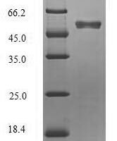 Reston ebolavirus Matrix protein VP40 (VP40) Recombinant Protein - BioCrest Sci
