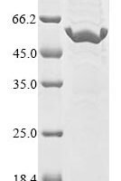 Human Ribonuclease 4 (RNASE4) Recombinant Protein, N-MBP/C-His - BioCrest Sci
