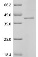 Human Carboxypeptidase A4 (CPA4) Recombinant Protein - BioCrest Sci
