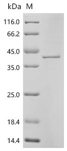 Human Carboxypeptidase A4 (CPA4) Recombinant Protein, Homo sapiens (Human), E.coli, C-terminal 6xHis-tagged, 41.4 kDa, purity >≥ 90% as determined by SDS-PAGE.