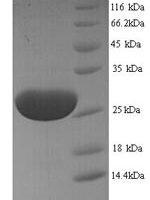 Trichosanthes kirilowii Ribosome-inactivating protein karasurin-C Recombinant Protein, N-His - BioCrest Sci